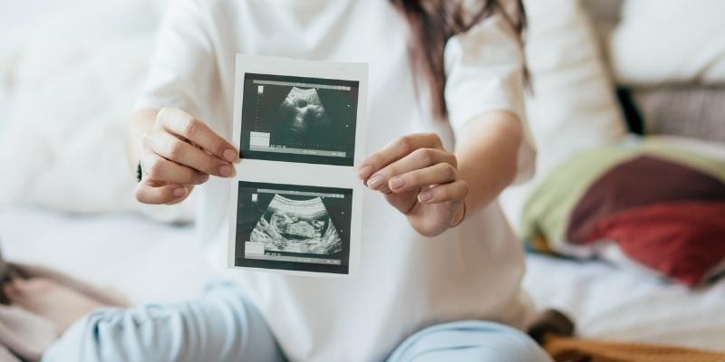 ¿Cuántas ecografías son necesarias en el embarazo?